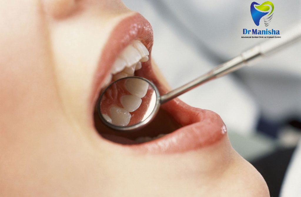 Learn how cavities form, their symptoms, and how to prevent and treat them effectively. Expert insights from the Best Dental Clinic in Pimpri-Chinchwad.