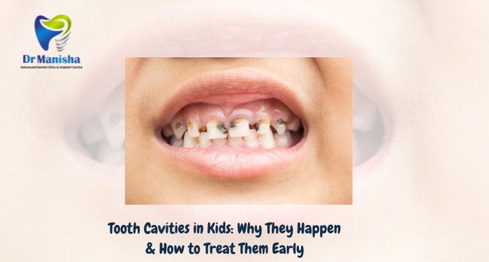 Understand the causes, symptoms, and treatment options for child tooth cavities. Learn how early care, hygiene habits, and regular dental visits can protect kids’ teeth.