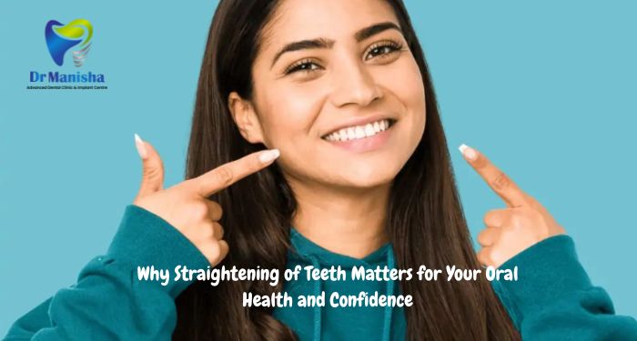 Why Straightening of Teeth Matters for Your Oral Health and Confidence