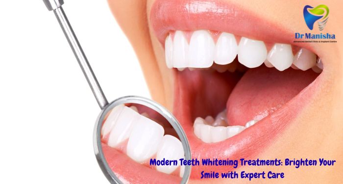Modern Teeth Whitening Treatments: Brighten Your Smile with Expert Care