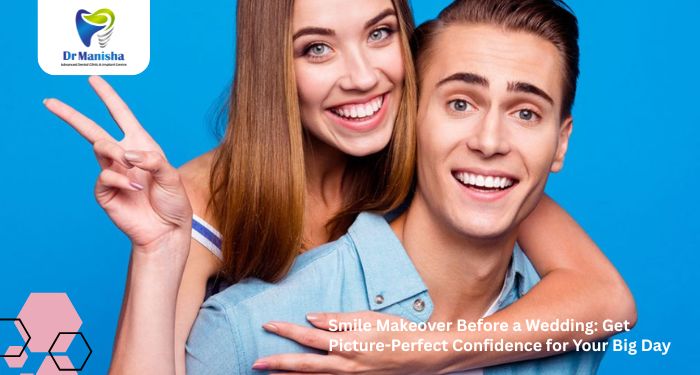 Smile Makeover Before a Wedding: Get Picture-Perfect Confidence for Your Big Day
