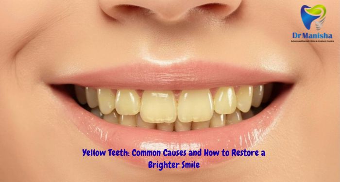 Yellow Teeth: Common Causes and How to Restore a Brighter Smile